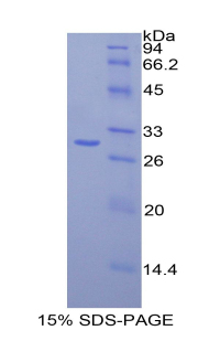 Recombinant Fatty Acid Synthase (FASN)