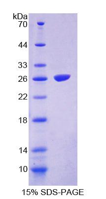 Recombinant Fas Activated Serine/Threonine Kinase (FASTK)