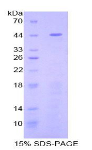 Recombinant Fibulin 1 (FBLN1)