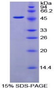 Recombinant Fibrinogen Gamma (FGg)