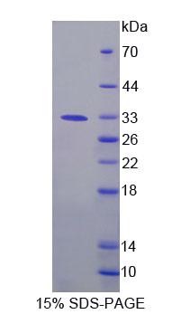 Recombinant Fucose-1-Phosphate Guanylyltransferase (FPGT)