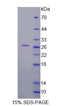 Recombinant Follicular Lymphoma Variant Translocation 1 (FVT1)