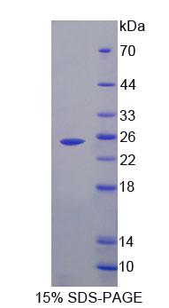 Recombinant Fibrillarin (FBL)