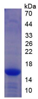 Recombinant Friend Leukemia Virus Integration 1 (FLI1)