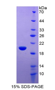 Recombinant Frataxin (FXN)