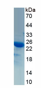 Recombinant Guanidinoacetate-N-Methyltransferase (GAMT)