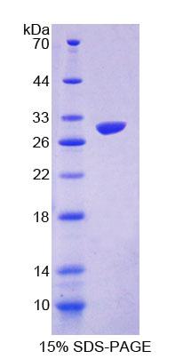Recombinant Guanidinoacetate-N-Methyltransferase (GAMT)