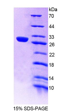 Recombinant Guanidinoacetate-N-Methyltransferase (GAMT)