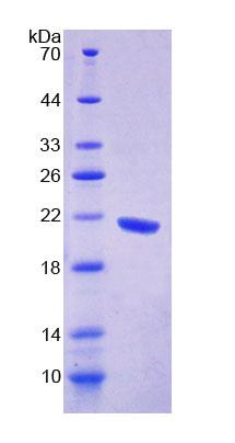 Recombinant G-Elongation Factor, Mitochondrial 1 (GFM1)