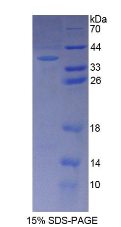 Recombinant Geranylgeranyl Diphosphate Synthase 1 (GGPS1)