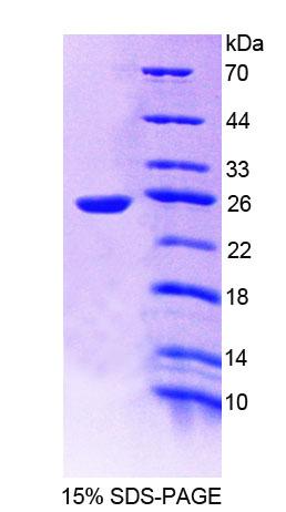 Recombinant Geranylgeranyl Diphosphate Synthase 1 (GGPS1)