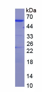 Recombinant Glucocerebrosidase (GBA)