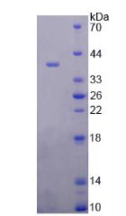 Recombinant Prostate-specific Membrane Antigen (PMSA)