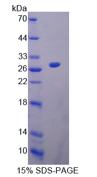 Recombinant Heart And Neural Crest Derivatives Expressed Protein 1 (HAND1)