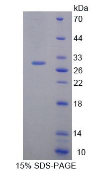 Recombinant Heart And Neural Crest Derivatives Expressed Protein 1 (HAND1)