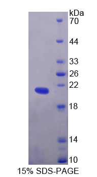 Recombinant Helicase Like Transcription Factor (HLTF)