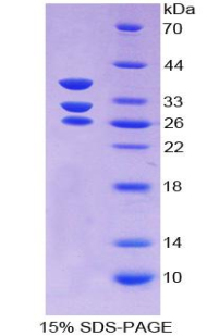 Recombinant Islet Cell Autoantigen 1 (ICA1)