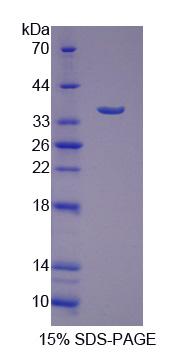 Recombinant Intestinal Cell Kinase (ICK)