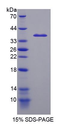Recombinant Intestinal Cell Kinase (ICK)