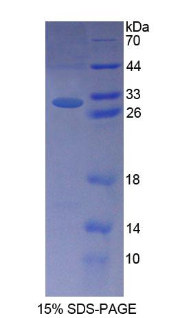 Recombinant Nephronophthisis 2, Infantile (NPHP2)
