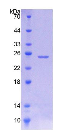 Recombinant Junctophilin 1 (JPH1)