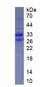 Recombinant Katanin P60 Subunit A 1 (KATNA1)