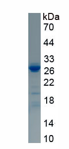 Recombinant Katanin P60 Subunit A 1 (KATNA1)