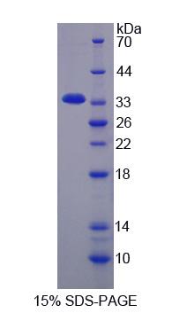 Recombinant Keratocan (KERA)