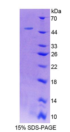 Recombinant Ladinin 1 (LAD1)