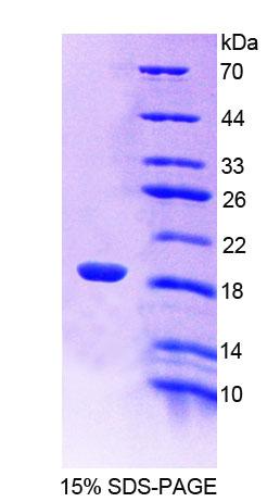 Recombinant Leucine Zipper, Down Regulated In Cancer 1 (LDOC1)