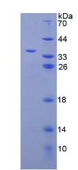 Recombinant Lectin, Mannose Binding 1 (LMAN1)