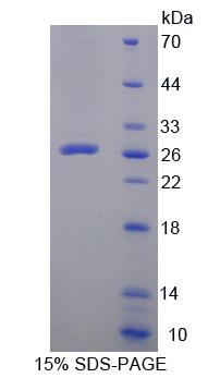 Recombinant Leupaxin (LPXN)