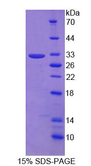 Recombinant Leucine Rich Repeats And Death Domain Containing Protein (LRDD)