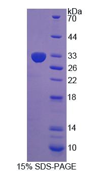 Recombinant Leucine Rich Repeats And Death Domain Containing Protein (LRDD)