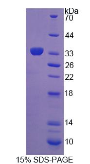 Recombinant Lymphocyte Specific Protein 1 (LSP1)