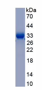 Recombinant Lysyl Oxidase (LOX)