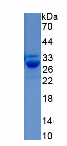 Recombinant Uridine Cytidine Kinase 2 (UCK2)