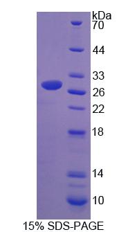 Recombinant Beta-ureidopropionase (UPB1)