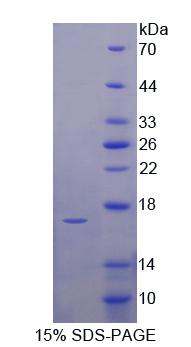 Recombinant Uroplakin 1A (UPK1A)