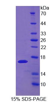 Recombinant Uroplakin 1A (UPK1A)