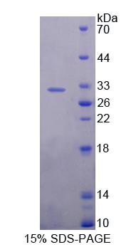 Recombinant Ubiquitin Specific Peptidase 1 (USP1)