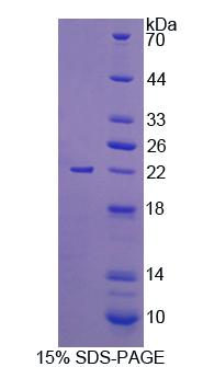 Recombinant Uridine Monophosphate Synthetase (UMPS)
