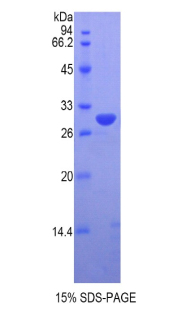 Recombinant Vaccinia Related Kinase 1 (VRK1)