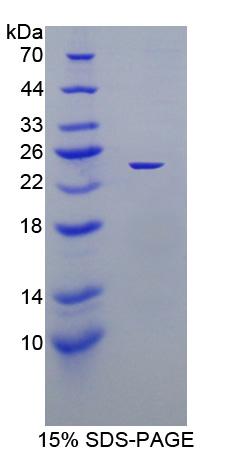 Recombinant Xanthine Dehydrogenase (XDH)