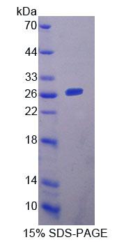 Recombinant YY1 Associated Factor 2 (YAF2)