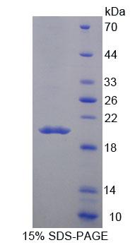 Recombinant Macrophage Receptor With Collagenous Structure (MARCO)