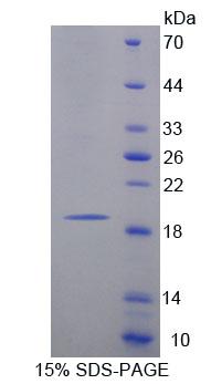 Recombinant Macrophage Receptor With Collagenous Structure (MARCO)