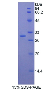 Recombinant Multimerin 1 (MMRN1)