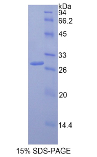 Recombinant Multimerin 1 (MMRN1)