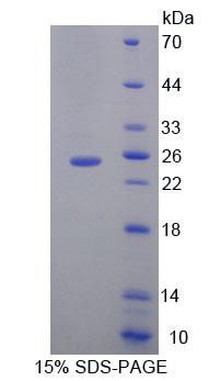 Recombinant Molybdenum Cofactor Synthesis 1 (MOCS1)